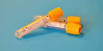 Envelhecimento Biológico Acelerado e Cancro Antes dos 55 Anos: o Que Diz o Estudo da Nature Medicine