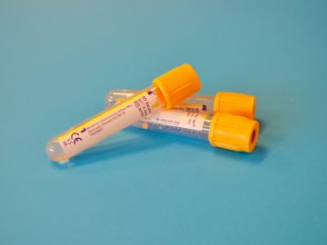 Envelhecimento Biológico Acelerado e Cancro Antes dos 55 Anos: o Que Diz o Estudo da Nature Medicine