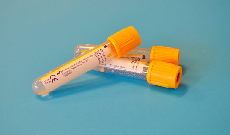 Envelhecimento Biológico Acelerado e Cancro Antes dos 55 Anos: o Que Diz o Estudo da Nature Medicine