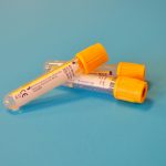 HOMA-IR e os Novos Índices de Resistência à Insulina: Vale a Pena Pedir?