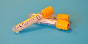HOMA-IR e os Novos Índices de Resistência à Insulina: Vale a Pena Pedir?