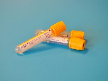 HOMA-IR e os Novos Índices de Resistência à Insulina: Vale a Pena Pedir?