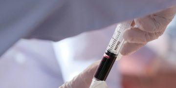 Testes de Deteção Precoce de Múltiplos Cancros: O Que Sabemos Antes da Decisão da FDA