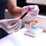 Rastreio do Cancro Colorretal: as Novas Opções que a American Cancer Society Acrescentou em 2026