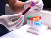 Rastreio do Cancro Colorretal: as Novas Opções que a American Cancer Society Acrescentou em 2026