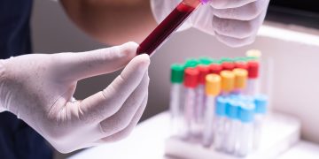 Rastreio do Cancro Colorretal: as Novas Opções que a American Cancer Society Acrescentou em 2026
