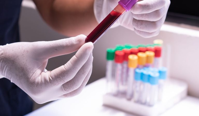 Rastreio do Cancro Colorretal: as Novas Opções que a American Cancer Society Acrescentou em 2026
